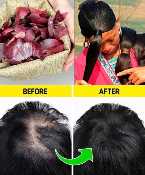 Unlock the Secret to Strong, Healthy Hair with Onion Peels