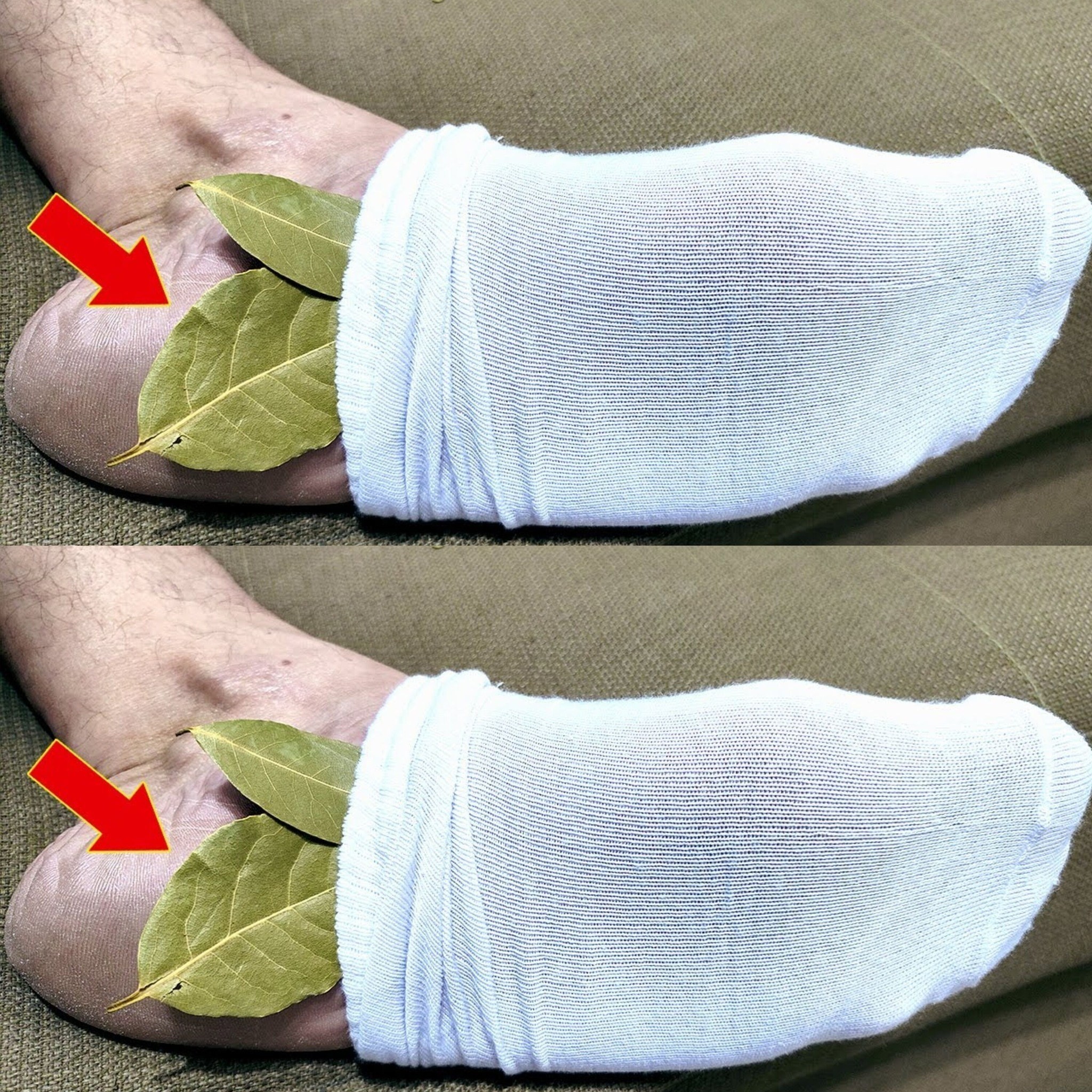 Put 1 Bay Leaf on Your Feet and No Longer Need to Spend Money at the Pharmacy (Did You Know That?)