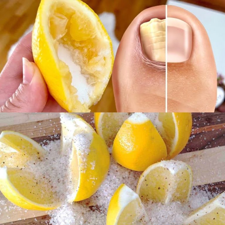 Nail Fungus Removal: 100% Natural Treatment for Toenail Fungus with Lemon and Salt