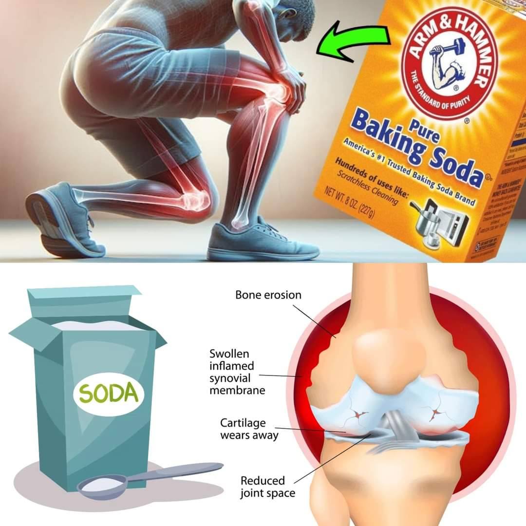 Doctors Surprised by the Effective Use of Baking Soda for Joint Pain Relief